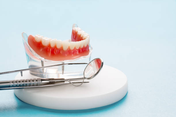 Dental Bonding in Belle Mead, NJ